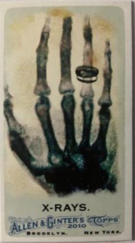 X Rays [Mini Bazooka Back] #185