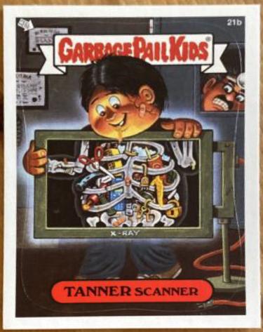 TANNER Scanner #21b