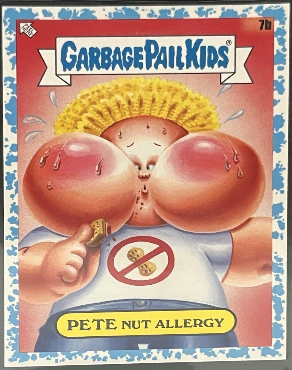 PETE Nut Allergy [Blue] #7b