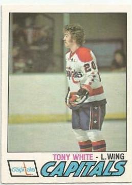 Tony White #314