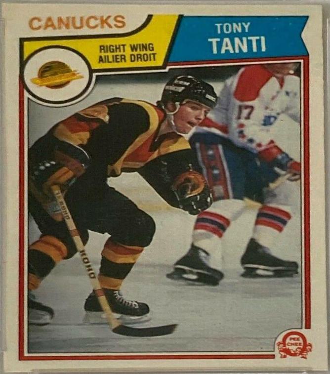 Tony Tanti #362
